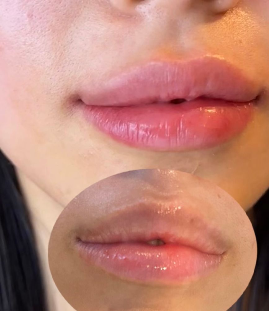 After: evenly soft pink lips. The small oval photo shows the lips before: nude pink with brownish edges and a slightly darker upper lip.