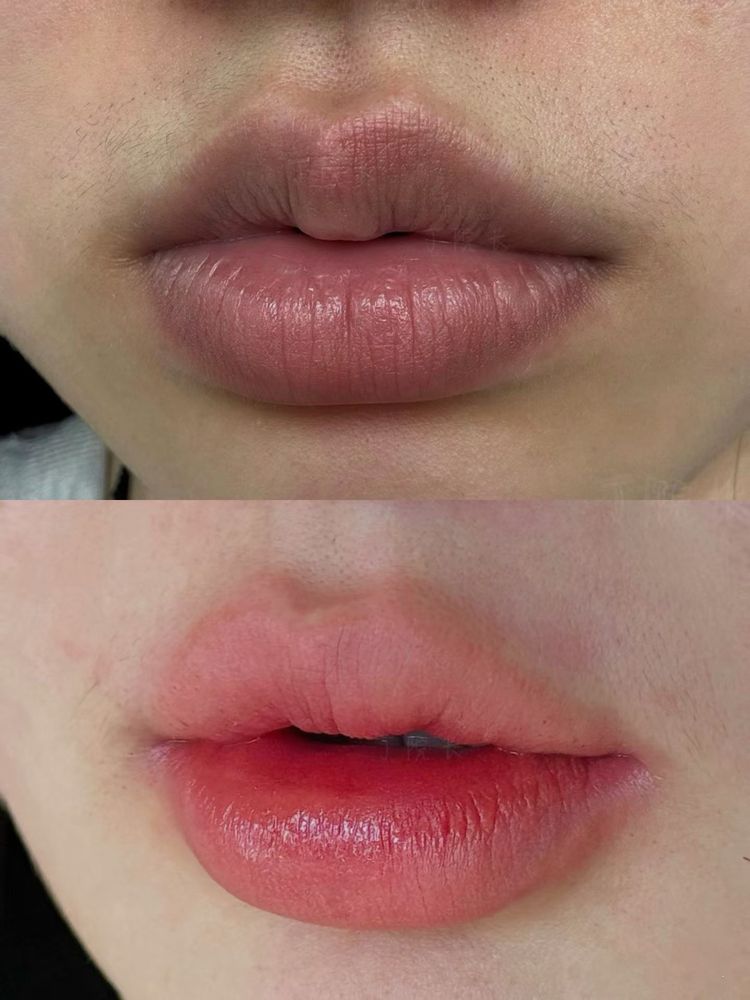 Top, before: dusky mauve-brown lips with a darker upper lip and border. Below, after: even pink-coral lips.